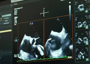 Cardiobat porta a Trani la cardiologia salva vita del futuro