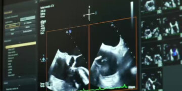 Cardiobat porta a Trani la cardiologia salva vita del futuro