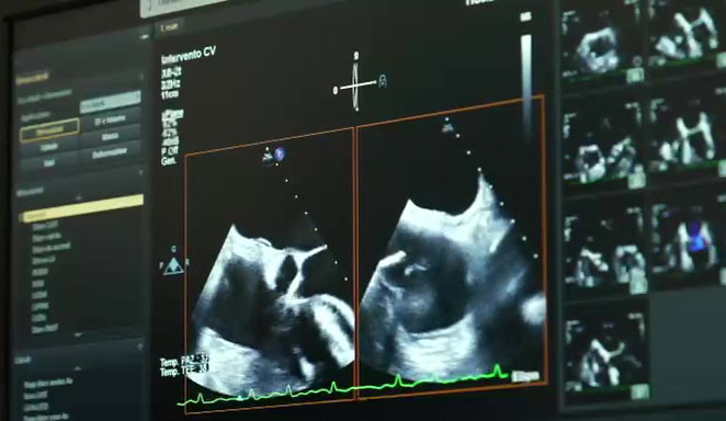 Cardiobat porta a Trani la cardiologia salva vita del futuro