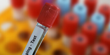 Doping: Pregliasco, il letrozolo nella liste nera degli atleti