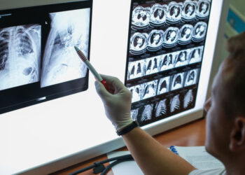 Tumore al polmone,un secondo parere medico da ‘I 100 Medici eccellenti d’Italia’