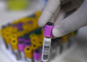 Tubercolosi, verso test sangue ultra-sensibile per diagnosi infezione latente o iniziale