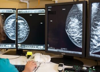 Tumore al seno, con la diagnosi precoce la sopravvivenza a 10 anni supera il 90%