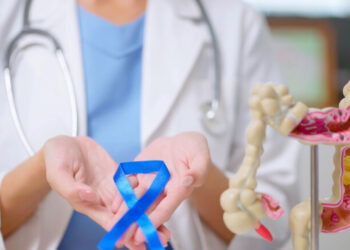 Tumore colon, dopo la chirurgia prelievi di sangue aiuteranno a capire rischio recidive